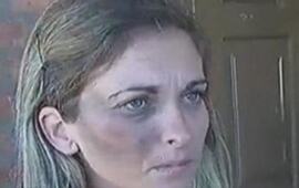 La joven madre presenta un hematoma en el p&oacute;mulo derecho, producto de los golpes recibidos por un ladr&oacute;n. Foto v&iacute;a Twitter