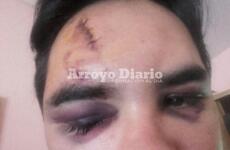 Casi irreconocible. As&iacute; le qued&oacute; el rostro tras el ataque.