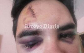 Casi irreconocible. As&iacute; le qued&oacute; el rostro tras el ataque.