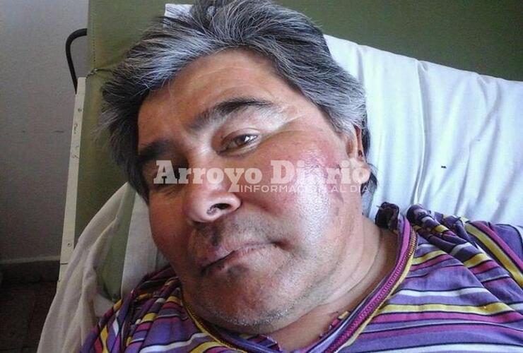 Lastimado y golpeado. Balduini con los vestigios de la agresión en su rostro pero afortunadamente con vida.