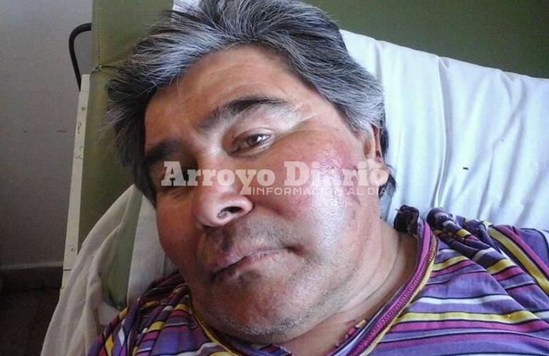 Lastimado y golpeado. Balduini con los vestigios de la agresión en su rostro pero afortunadamente con vida.