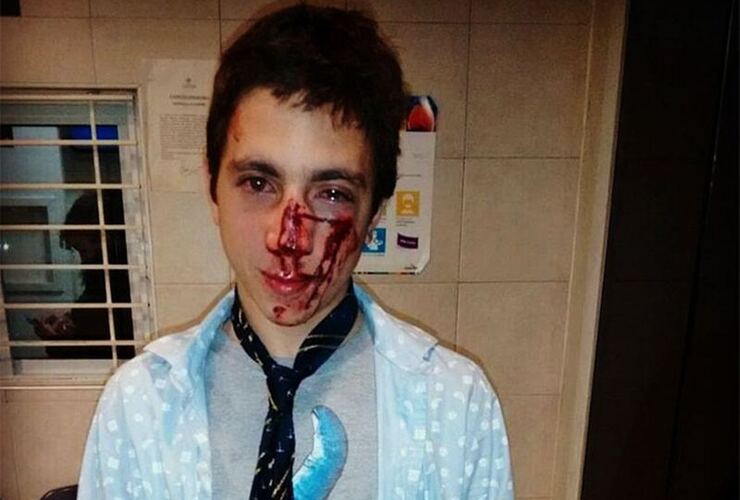 Imagen de Un joven fue brutalmente golpeado por una patota a la salida de un boliche