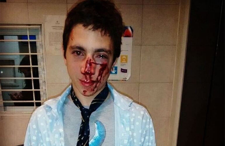 Imagen de Un joven fue brutalmente golpeado por una patota a la salida de un boliche