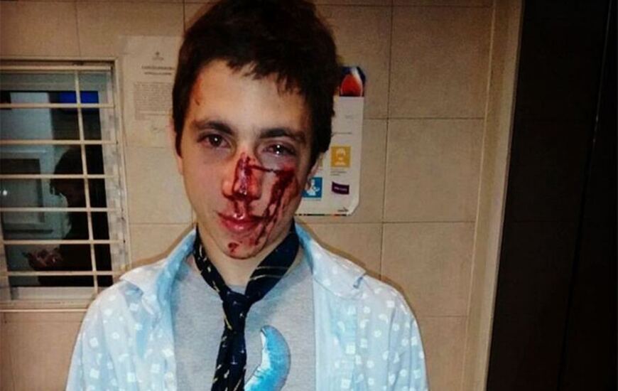 Imagen de Un joven fue brutalmente golpeado por una patota a la salida de un boliche