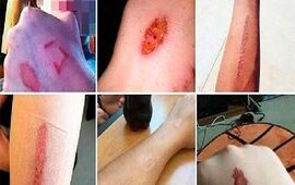 Imagen de Advierten sobre un juego de Facebook que incita al suicidio