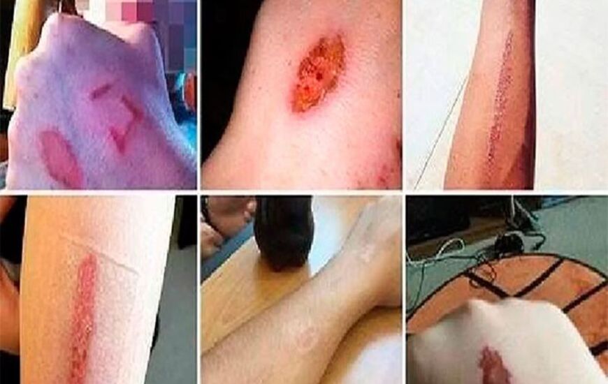 Imagen de Advierten sobre un juego de Facebook que incita al suicidio