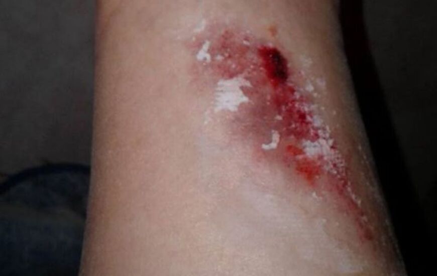 En face. La joven public&oacute; el incidente a trav&eacute;s de la red social facebook junto a una serie de im&aacute;genes