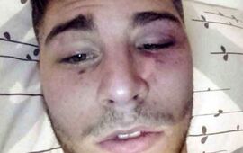 Las lesiones en el rostro de Mateo.