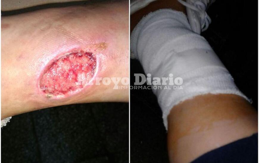 Las im&aacute;genes fueron enviadas por la joven mujer domiciliada en General Lagos.