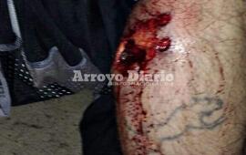 &iquest;Abuso de autoridad?. Los familiares de los vecinos v&iacute;ctimas de las lesiones aducen que la polic&iacute;a actu&oacute; excesivamente y no justifican las agresiones.