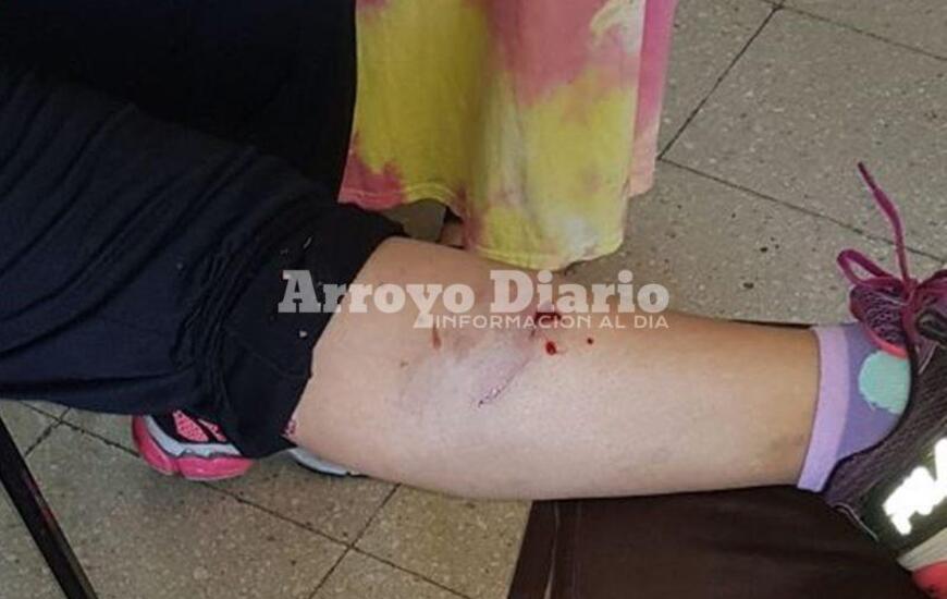 Lastimada y dolorida. La vecina result&oacute; con varias mordidas tras el ataque de los perros que la abordaron en inmediaciones de la Plaza 9 de Julio.