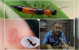 Imagen de El Ministerio de Salud Provincial alerta sobre la presencia del Bicho del fuego