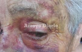 La imagen habla por sí misma. Indignación generalizado tras el ataque que sufrió la anciana.