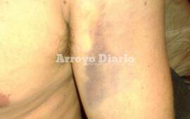 Según trascendió, el agresor practicaría alguna disciplina de la rama del combate.