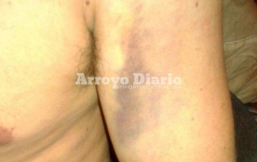 Según trascendió, el agresor practicaría alguna disciplina de la rama del combate.