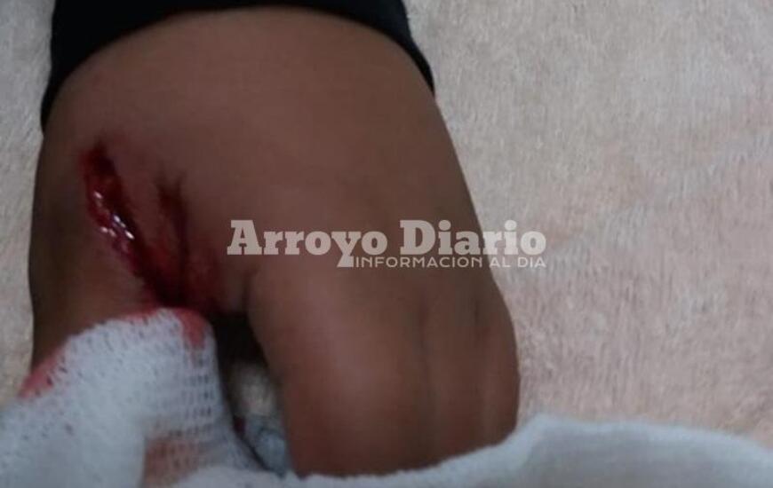 Imagen de Perro callejero mordi&oacute; a un nene de 7 a&ntilde;os