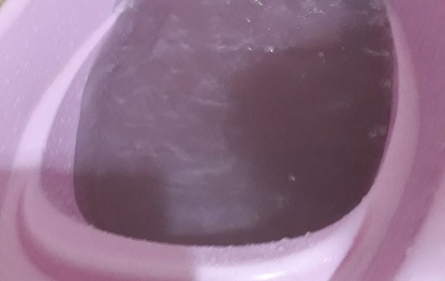 Las fotos tomadas por la vecina en el d&iacute;a de hoy.