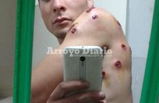 Uno de los j&oacute;venes fue atacado con postas de goma.