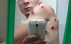Uno de los jóvenes fue atacado con postas de goma.