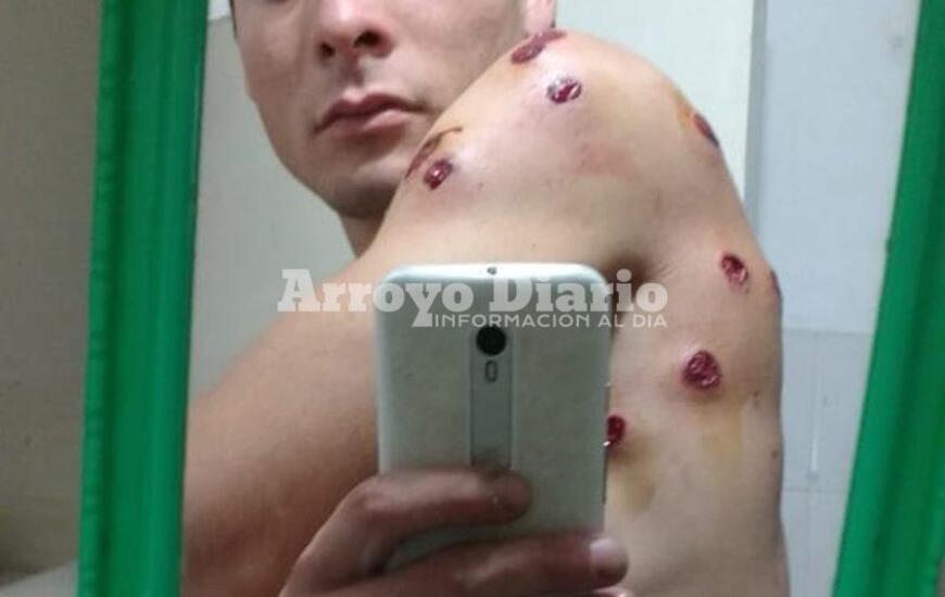 Uno de los j&oacute;venes fue atacado con postas de goma.