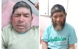 En el Hospital hasta le cortaron el cabello. Foto: Faceook