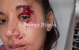 A raíz de una de las heridas, recibió varios puntos de sutura sobre la zona del párpado.