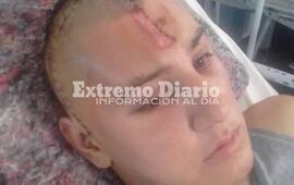 Imagen de Ya est&aacute; en su casa: Dieron de alta al chico accidentado