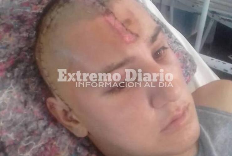 Imagen de Ya está en su casa: Dieron de alta al chico accidentado