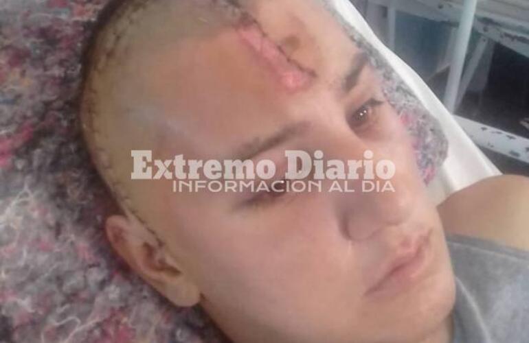 Imagen de Ya está en su casa: Dieron de alta al chico accidentado