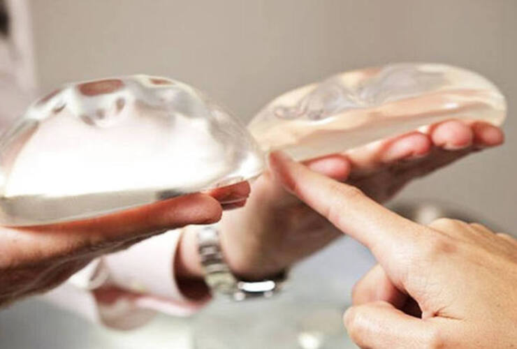 Imagen de Muri&oacute; una mujer tras una cirug&iacute;a de correcci&oacute;n mamaria