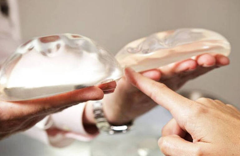 Imagen de Muri&oacute; una mujer tras una cirug&iacute;a de correcci&oacute;n mamaria