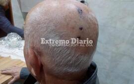 Imagen de Delincuentes asaltan y golpean a conocido comerciante