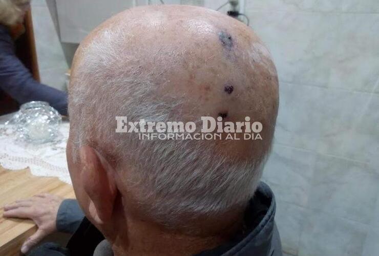 Imagen de Delincuentes asaltan y golpean a conocido comerciante