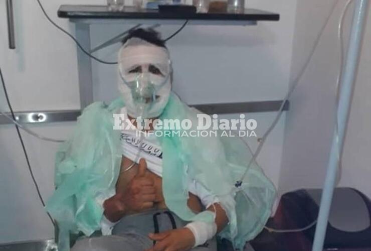 El muchacho de 28 años permaneció en el HECA y por las quemaduras tiene por delante tres meses de tratamiento.