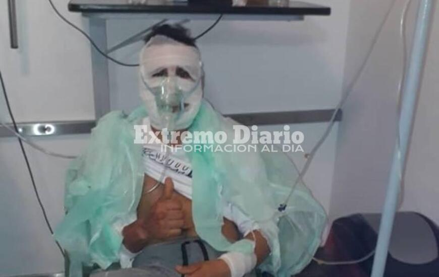 El muchacho de 28 años permaneció en el HECA y por las quemaduras tiene por delante tres meses de tratamiento.