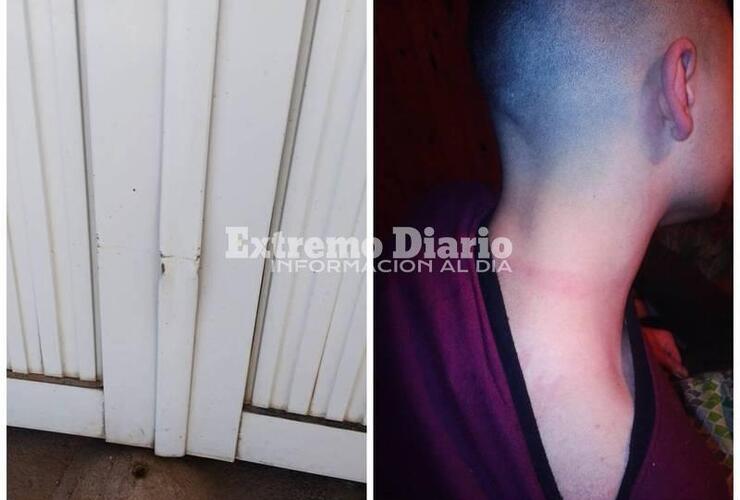 Foto 1.- Daños en el portón de la casa - Foto 2.- Las marcas que supuestamente la policía le dejó en el cuello de uno de los adolescentes.