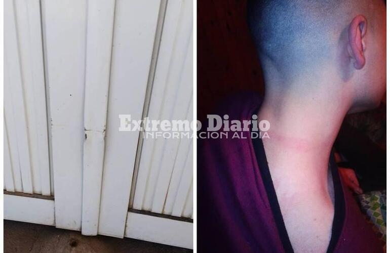 Foto 1.- Daños en el portón de la casa - Foto 2.- Las marcas que supuestamente la policía le dejó en el cuello de uno de los adolescentes.