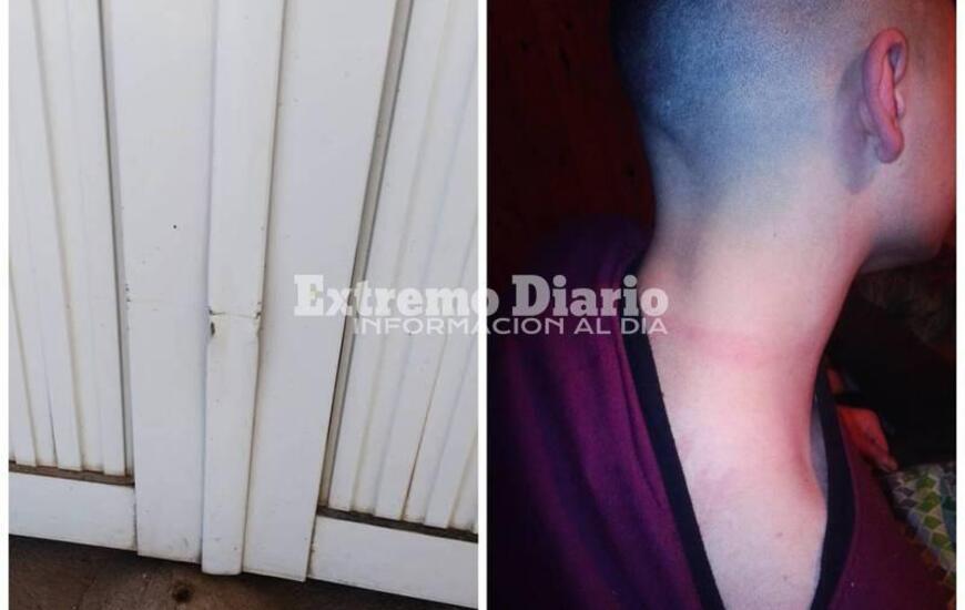 Foto 1.- Da&ntilde;os en el port&oacute;n de la casa - Foto 2.- Las marcas que supuestamente la polic&iacute;a le dej&oacute; en el cuello de uno de los adolescentes.