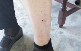 Imagen de Perro callejero la mordi&oacute; frente a la Municipalidad