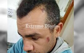 Imagen de Habl&oacute; Luciano Cuenca tras el conflicto por tierras que culmin&oacute; con su arresto