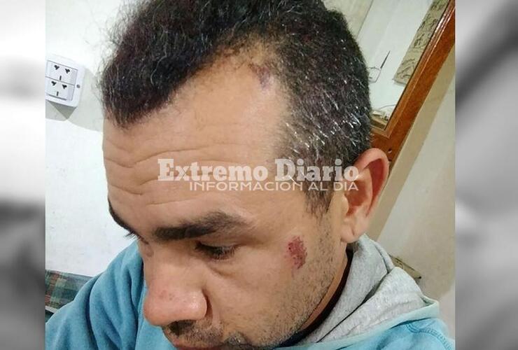 Imagen de Habló Luciano Cuenca tras el conflicto por tierras que culminó con su arresto