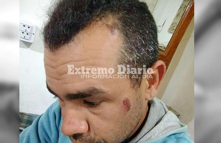 Imagen de Habló Luciano Cuenca tras el conflicto por tierras que culminó con su arresto