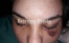 Imagen de Denunci&oacute; que su marido le dio una feroz golpiza