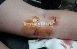 En la pierna. En el efector p&uacute;blico tuvieron que suturarlo.