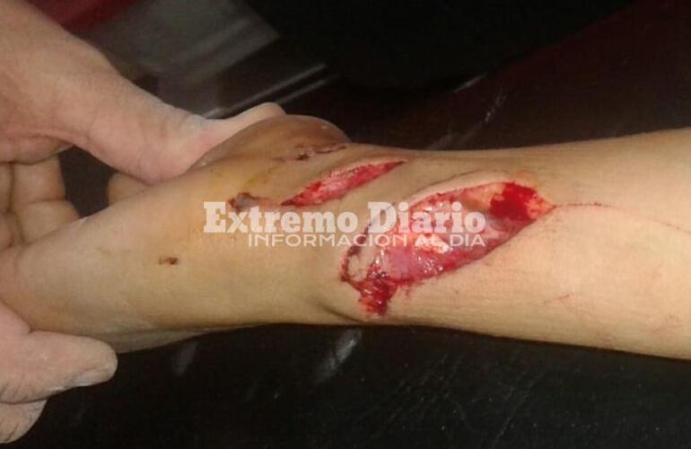 El menor y su mam&aacute; contaron lo sucedido.