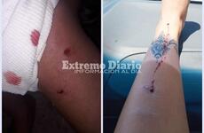 Imagen de Una nena y una mujer resultaron mordidas por el mismo perro