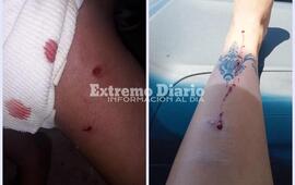 Imagen de Una nena y una mujer resultaron mordidas por el mismo perro