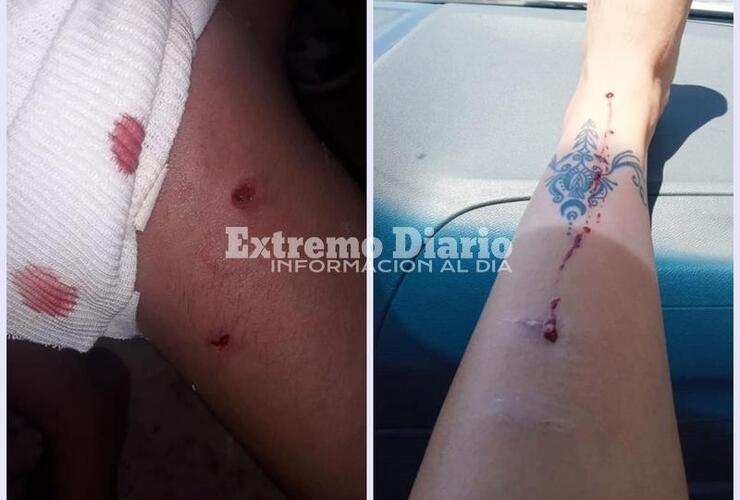 Imagen de Una nena y una mujer resultaron mordidas por el mismo perro