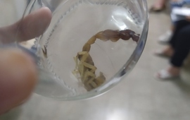 La mam&aacute; llevo al ar&aacute;cnido en un frasco