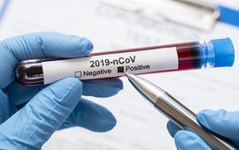 Imagen de Hablaron los dos hombres que dieron positivo al test de Coronavirus